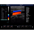 Nuevo escáner de diagnóstico por ultrasonido doppler color portátil general con software 3d 4d